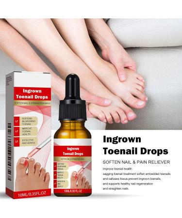  Qkbuza Nail and Toenail Strengthening Liquid | 10ml Ingrown Toenail Corrector Drops | Beauty Care for Hands and Feet - Nighttime Travel Treatment for Dry Damaged Cracked Curved Fragile and Chipped Nails - Buy Online on GoSupps.com