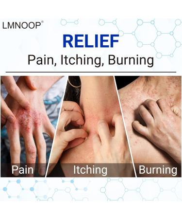 LMNOOP Eczema Cream: Maximum Strength Treatment for Rash, Psoriasis, Dermatitis, and More - Buy Online on GoSupps.com