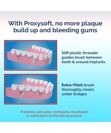 Dental Floss for Bridges and Dental Implants for Optimal Oral Hygiene - Floss Threaders for Bridges and Implants with Extra-Thick Proxy Brush - Bridge and Implant Cleaners (2 Packs) by ProxySoft - Buy Online on GoSupps.com