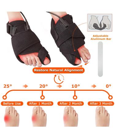 CAMECO Red Light Therapy Device for Feet | Near Infrared Treatment for Hallux Valgus - International Shipping Available - Buy Online on GoSupps.com