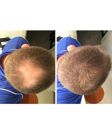 Caboki VALUE PACK 2 (3 x 30 gram plus one Volume Control Mist) 270-Day Supply Light Brown - Buy Online on GoSupps.com