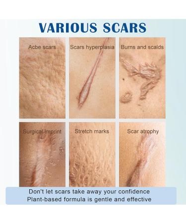 Scar Gel for Kids & Adults - Scar Cream Reduces Visibility of Scars & Decreases Tissue Tension & Itching - for All Types of Scars - Fast Absorption - Buy Online on GoSupps.com