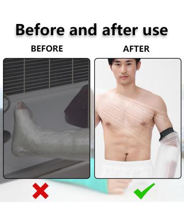 Waterproof Arm Cover 30cmx22cm - Reusable & Soft Cast Protector for Shower - Adult & Kids - Buy Online on GoSupps.com