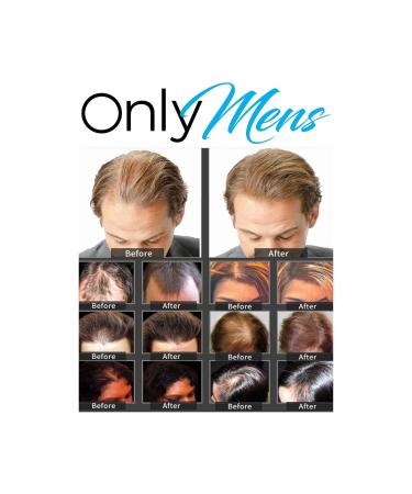 Shop Dark Brown Hair Fibers for Instant Thickness | Worldwide Shipping Available - Buy Online on GoSupps.com