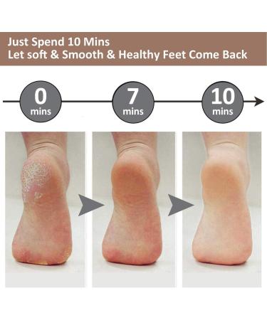 Joselin Pedicure Foot File Callus Remover Large Foot Rasp Colossal Foot Washer Foot Tools Professional Care Health - Buy Online on GoSupps.com