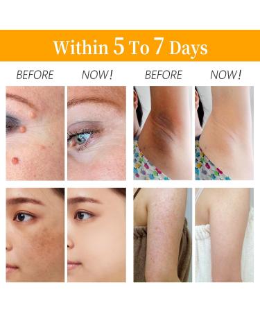 Bee Venom Professional Treatment Cream | 2024 Hydrating Moisturizer for Men & Women | International Shipping Available - Buy Online on GoSupps.com