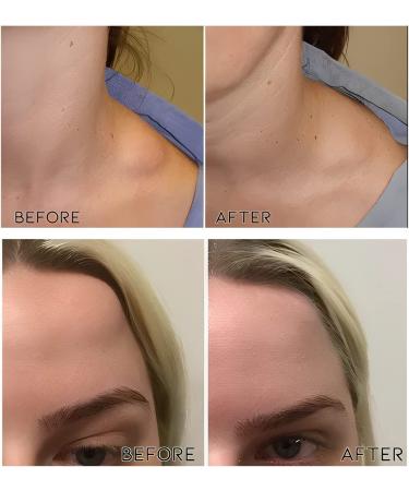 3pcs Lipoma Removal Cream for Anti-Swelling & Cellulite Elimination | Lymphatic Ointment for Lipoma Exfoliation - Buy Online on GoSupps.com