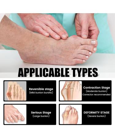 ERGOic Bunion Relief Socks - Anti-Bunion Health Socks for Women and Men - Bunion Corrector Toe Align Socks (Black 5 Pairs) - Buy Online on GoSupps.com