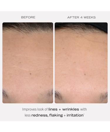First Aid Beauty Retinol Complex Serum & Eye Cream - Reduce Lines & Wrinkles with Peptides Squalane & Ceramides - Gentle Retinol for All Skin Types - Buy Online on GoSupps.com