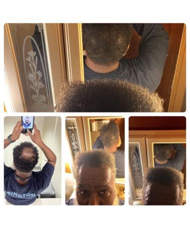 Sea Moss Collagen Hair & Skin Oil | Fenugreek Rosemary Nettle Ginseng Ylang for Hair Growth & Youthful Skin - Buy Internationally - Buy Online on GoSupps.com