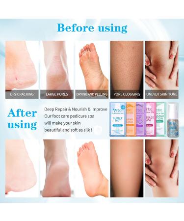 nbc BeautiLab Pedicure Foot Soak Set - Upgraded 6 in 1 Foot Spa Foot Bath Spa Pedicure Kit Foot Soak for Tired & Dry Cracked Feet Athletes Feet and Calluses (Pacific Waves) Lavender - Buy Online on GoSupps.com
