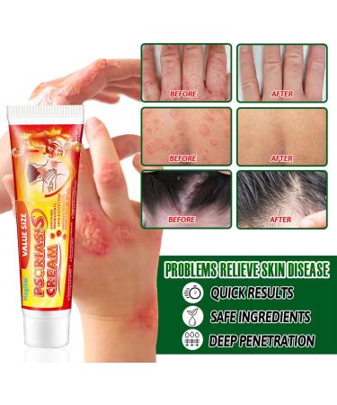  MagiSel Anti-itch ointment skin cream soothing skin cream for itching and psoriasis natural care formula cares for and soothes the skin suitable for skincare - Buy Online on GoSupps.com