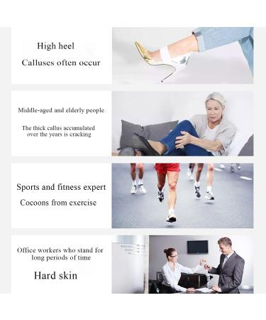Electric Foot Callus Remover Pain-Free Electric Callus Remover with 60pcs Sanding Discs Foot Grinder for Dead Skin and Cracked Heel (Pink) - Buy Online on GoSupps.com