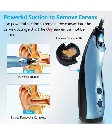 Rechargeable Electric Ear Wax Vacuum Remover - 3 Levels Suction | Safe & Gentle Earwax Removal Tool for Adults & Kids - Buy Online on GoSupps.com