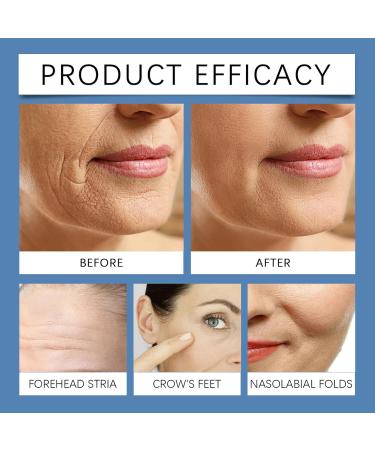 Instant Eye Lift Serum Anti-wrinkle Roller Essences Anti Poche Sous les Yeux Serum Liftante Instantan e pour att nuer les poches sous yeux et les cernes anti cerne homme Korean Skincare (30ML 1PC) 1PC 30 ml (Lot de 1) - Buy Online on GoSupps.com