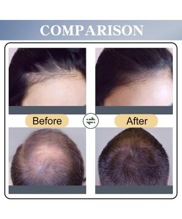 Hair Growth Spray with Natural Oils and Biotin - Nurturing Scalp Effective Hair Thickening for Women & Men - Castor Oil Rosemary Leaf Oil - Buy Online on GoSupps.com