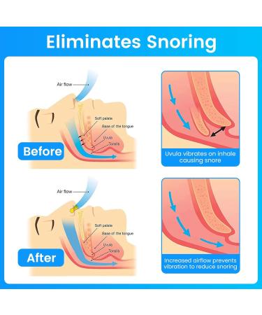 Silicone Magnetic Anti Snore Nose Clip 6pcs for Women - Stop Snoring Devices - Buy Online on GoSupps.com