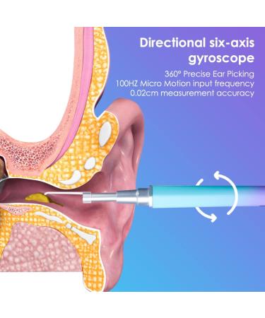 Wireless Visual Otoscope Ear Cleaning Tool with HD Endoscopy for Ear Wax Removal - Buy Online on GoSupps.com