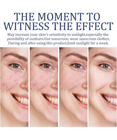 Faded Topicals for Dark Spots - Salicylic Acid Serum - Dark Spot Correcting Glow Serum - Moisturizing Niacinamide Serum with Vitamin C - Dark Spot Remover for Face - Removing Acne and Controlling Oil - Buy Online on GoSupps.com