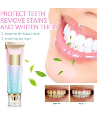 Niacinamide Whitening Toothpaste with Niacinamide 100 g Niacinamide Whitening Toothpaste Teeth Whitening Toothpaste Stain Removal and Whitening - Buy Online on GoSupps.com