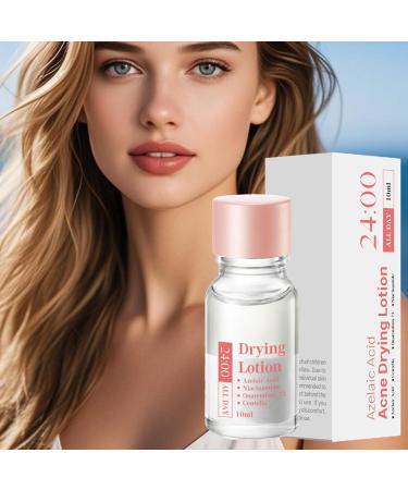 Spot Lotion 10 ml Drying Solution for Spots and Moisturizers | Fast-Acting Liquid for Facial Blemishes for Women for Daily and Nighttime Use Travel and - Buy Online on GoSupps.com