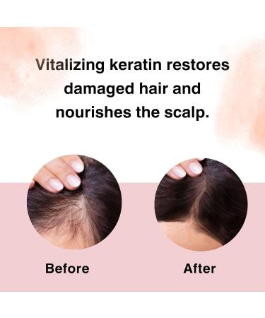 Moist Diane Perfect Beauty Extra Vital Treatment - Sulfate-Free Hair Care with Organic Argan Oil & Keratin | 15.2 fl oz Rejuvenate Silky Smooth Hair for Men & Women - Imported from Japan - Buy Online on GoSupps.com