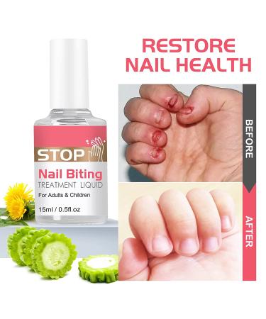 Nail Biting Treatment for Kids & Adults,No Bite Nail Polish to Help Stop  Nail Biting,Pure Plant Extract,Bitter Taste,Safe for Children( Fluid  Ounces) original