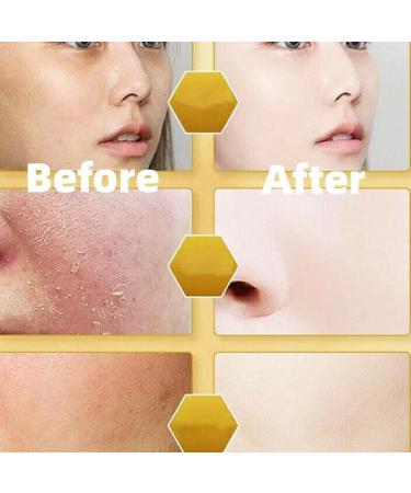 EXQST Astragalus Moisturizing Cream Astragalus Nourishing Cream 70g Astragalus Moisturizing Beauty Cream Autumn and Winter Skin Care Products - Buy Online on GoSupps.com