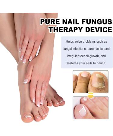 SenhE Fungus Laser Therapy Device Antibacterial Laser Equipment Light Therapy Device Fungal Nail Revolutionary High-Efficiency Light Therapy Device for Toenail Diseases  - Buy Online on GoSupps.com