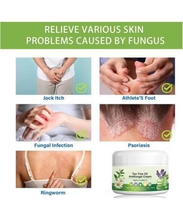 Nuvilo Antifungal cream with tea tree oil moisturizing cream for feet and hands relieves itchy skin - Buy Online on GoSupps.com