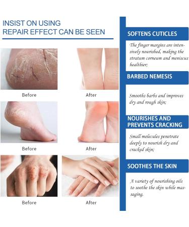 Foot Cream Callus Remover for Dry And Hard Skin Foot Nourishing Cream Deep Moisturizing Callus Remover and Soften Hard Skin Remover for Hand and Foot Care 50G - Buy Online on GoSupps.com