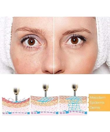  HUSANGE 05 Ml Ampulkop Hyaluronzuurpen Ampulkop 15st Pleasant63 - Buy Online on GoSupps.com