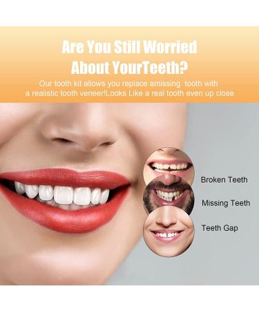 Temporary Tooth Repair Kit - Natural Shade Fake Teeth Filling for Missing or Broken Teeth - Yellow-09 - Buy Online on GoSupps.com