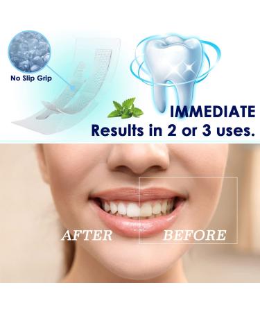 Teeth Whitening Strips Kit (28Pcs) - Sensitive Teeth Whitening Treatment - Buy Online on GoSupps.com