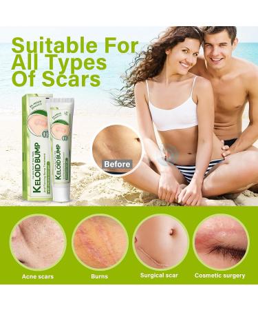 Scar Cream Gel 20g | Effective Keloid & Surgical Scar Removal | Professional Treatment for Old & New Scars | Gentle Formula for Face & Body - Buy Online on GoSupps.com