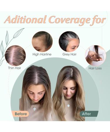 Clip in Hair Pieces for Women Extensions Toupee Hair Topper Hair Toppers for Thinning Hair Women Real Hair - Buy Online on GoSupps.com