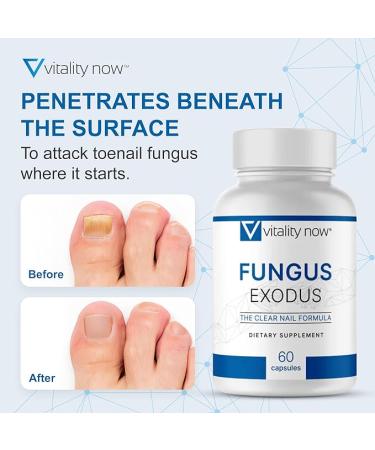Vitality Now Fungus Exodus - 60 Capsules for Healthier Feet | Premium Formula - Buy Online on GoSupps.com