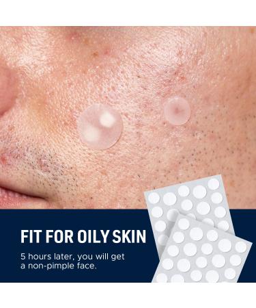 LitBear Acne Patch - 138 Professional Hydrocolloid Pimple Patches for Men - Tea Tree & Calendula Oil - 2 Sizes - Invisible Absorbing Cover Patch - Buy Online on GoSupps.com