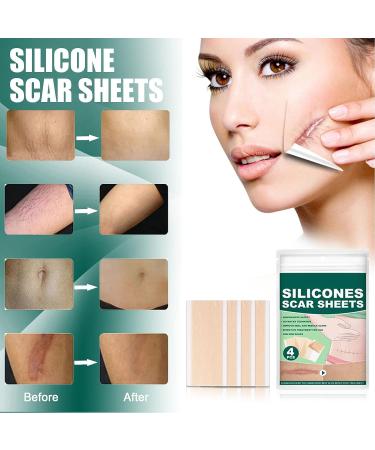 Professional Silicone Scar Removal Sheets - Reusable Gel Strips for Keloid, C-Section, Surgery, Burn, Acne - Stretch Marks Patch Away Tape - Buy Online on GoSupps.com