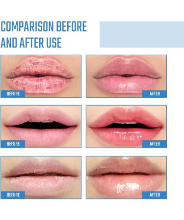 Collagen Lip Mask Pink Moisturizing Lip Patch Natural Collagen Lip Mask Overnight Anti-Aging And Anti-Chapped Reduce Lip Lines Under Lip Patches - Upgrade Lip Gel Pads (2pcs Blue) 2pcs Blue - Buy Online on GoSupps.com