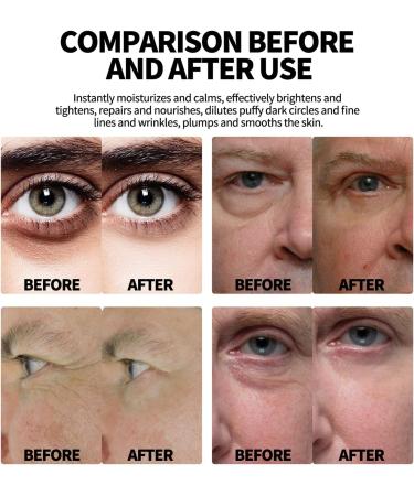 Brightening Energetic Eye Roller 10 Ml Energetic Under Eye Roller Prevents Skin Aging 3 Pieces Firming for Salon for Men - Buy Online on GoSupps.com