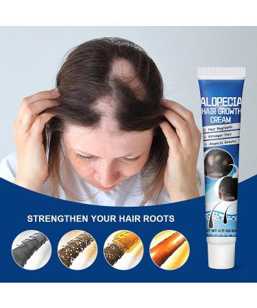  G n rique Baldness Cream - 20g Hair Growth Oil for Fast-Acting Effective Use Anti-Alopecia with High Hairline Solution Hairless Baldhead Hair Development Moisturizer for Men Women Thinning - Buy Online on GoSupps.com
