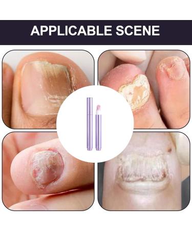 Stylo de soin des ongles 3 en 1 3.5ml repousse-cuticules et huile pour ongles repousse-cuticules stylo huile pour onglespourcuticules soins pour r parer lesongles secs et ab m s - Buy Online on GoSupps.com