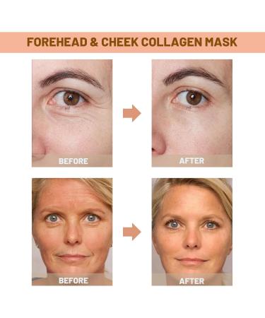 Collagen Forehead Patches For Wrinkles Hydrolyzed Collagen Face Tape Wrinkle Facial Patches To Help Reduce The Appearance Of Frown Lines Crow S Feet Smile Lines Forehead & Cheek Face Mask - Buy Online on GoSupps.com