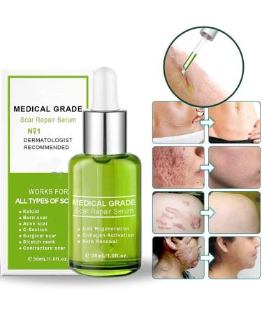 AXOIN Goopgen Advanced Scar Repair Serum - Medical Grade Scar Removal Cream for Nature Scar Treatment (1PCS) - Buy Online on GoSupps.com
