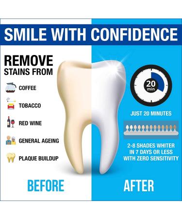 Intellident Teeth Whitening Kit with LED Light - Pro Gel for Longer Lasting Results - Stain Remover - Ideal for Sensitive Teeth - Buy Online on GoSupps.com