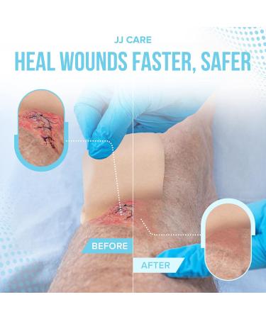 JJ CARE Hydrocolloid Dressing 6x6 Inch Pack of 5 - Thin Wound Dressing for Faster Healing of Bedsores, Blisters, and Acne - Buy Online on GoSupps.com