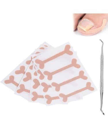 Ingrown Toenail Patch Nail Picker Pedicure Tool 20 Adhesive Stickers Toenail Correction Relief Prevention Suitable for Ingrown Thick Nails - Buy Online on GoSupps.com