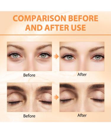 NYYQYYN Revive + Glow Vitamin C Eye Balm Hydrating Eye Cream Improve Dark Circles Refreshing and Non-Sticky (2 Pcs) - Buy Online on GoSupps.com