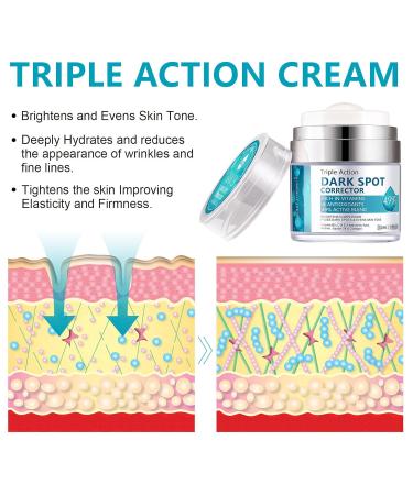 Crema para Manchas Oscuras en La Cara - Mejor Crema para Quitar Manchas 50 ML | Env o Internacional - Buy Online on GoSupps.com